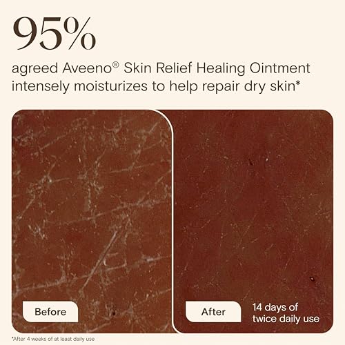 Image of Aveeno Skin Relief Healing Ointment, for Extra Dry, Cracked & Sensitive Skin, 72-Hour Protectant with Triple Oat, Shea Butter & Glycerin, Fragrance-Free for Body, Face, Hands, Lips 7.2 oz