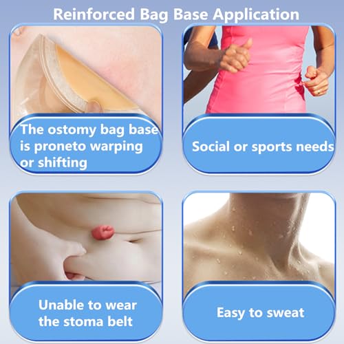 STEAWOCE Tiras de barreira de ostomia - 20 peças de fitas elásticas para bolsas de colostomia, exten