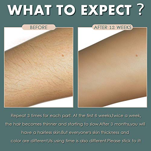 TUMAKOU Hair Removal System - Permanent Facial Body Hair Removal Device For Women& Man - 400000 Flashes - Professional Painless Hair Remover Epilator- Five Level Energys (Hair Removal Device)