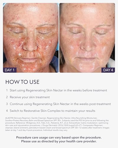 Image of ALASTIN Skincare Regenerating Skin Nectar Face Moisturizer (1 oz)