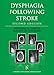 Dysphagia Following Stroke (Clinical Dysphagia)