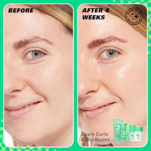 Image of Revolution Skin Clearly Clarify 4 Step Starter Kit, 4 Mini Products | Skincare Set for Blemish-Prone Skin with Cleanser, Toner, Serum & Moisturizer, Vegan & Cruelty-Free