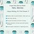 Angel Kiss Titanium Derma Roller for Face Body and Scalp - 192 Individual Needles 0.3mm - Microneedling Roller for Women and Men - Beard Roller for Men - Advanced 5