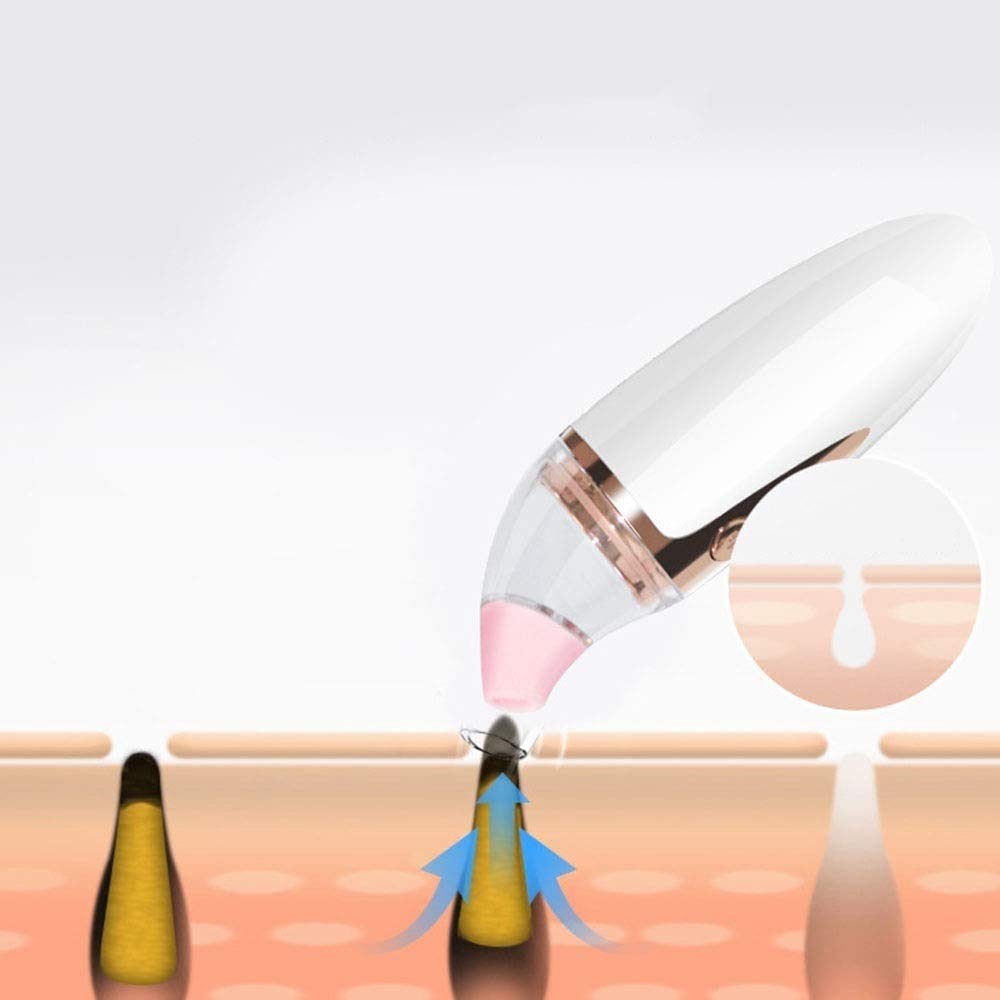 Blackhead Vacuum Removedor de vacío Vacuum Blackhead Removal Blackhead Blackhead Acne Extractor Herramienta de succión Limpiador de poros con 4 Cabezales de succión para la Piel Facial.