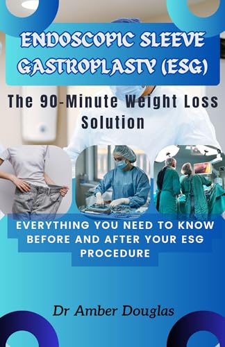 Endoscopic Sleeve Gastroplasty (ESG): The 90-Minute Weight Loss Solution. Everything You Need to Know Before and After Your ESG Procedure