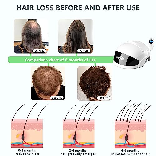 CLETINA Laser Hair Growth Treatment Helmet #TOP17