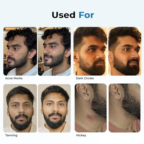 Image of Concealer Tool | Concealer Stick with SPF 30 & Vitamin E | Covers Dark Circles, Acne Scars, Spots & Hickeys | Sweat-Resistant Concealers For Men for Daily Wear | Medium Shade