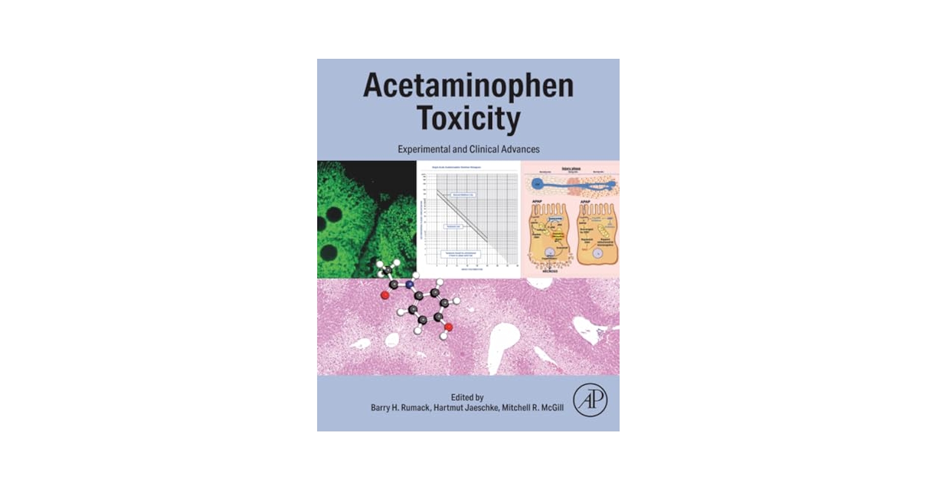 Acetaminophen: Properties， Clinical Uses and Adverse Effects (Pharmacology - Research， Safety Testing and Regulation; Public Health in the 21st Century) [ハードカバー] Javaherian， Atash; Latifpour， Pasha The molecular mechanisms of acetaminophen-induced