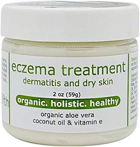 Made from Earth Eczema Cream for Dry Dermatitis Skin with Aloe & Vitamin E, 2oz