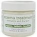 Eczema Treatment - Organic Aloe Vera , 2 oz
