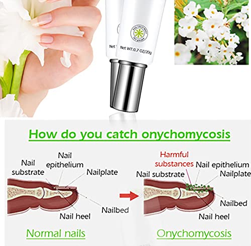 Toe Be Health Instant Beauty Gel, Nail Fungus Treatment for Toenail and Fingernail, Skin Healing Ointment for Cracked Heels and Dry Feet, Soothing Moisture Gel (2pcs)