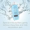 Neutrogena-Oil-and-Alcohol-Free-Facial-Toner-Hypoallergenic-Skin-Purifying-Face-Toner-to-Cleanse-Recondition-and-Purify-Skin-Non-Comedogenic-Quick-Absorbing-85-fl-oz Neutrogena Oil- and Alcohol-Free Facial Toner, Hypoallergenic Skin-Purifying Face Toner to Cleanse, Recondition and Purify Skin, Non-Comedogenic, Quick-Absorbing, 8.5 fl. oz