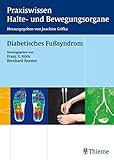 Diabetisches Fußsyndrom (Reihe, Praxisw. Halte-Bew.)