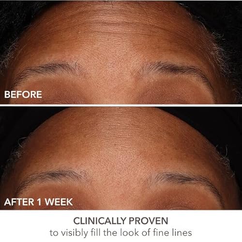 Dr Dennis Gross Derminfusions Fill + Repair Serum: Immediately Fills Lines, Plumps & Repairs, 1 Oz #TOP7