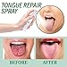 Tongue Repair Oral Health Spray, 30ml, for Glossitis, White Tongue and Dry Mouth, Twice Daily Use