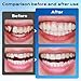 Tooth Repair Kit，Moldable Beads Instant Fix for Confident Smiles-2L