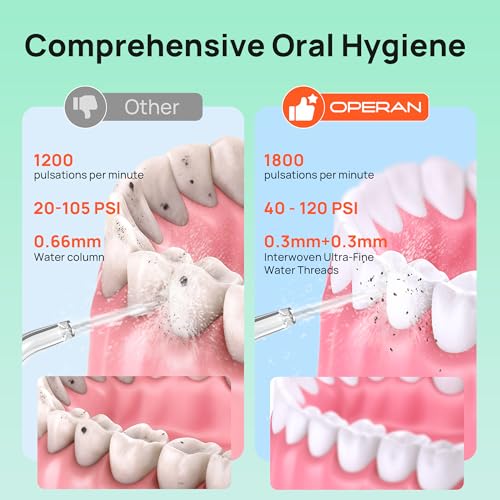 Image of Operan Water Picks, 4 Modes Travel Water Flosser Kit with 4 Tips, 300ml Portable Cordless Water Flosser for Teeth and Braces Care, Black, 1 Pack