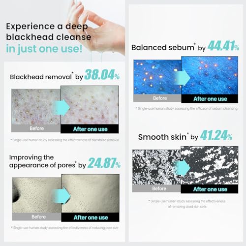 ilso Super Melting Sebum Cleansing Oil Watery Facial Cleanser