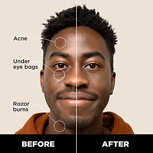 Stryx Concealer Pen Tool For Men, Deep Java - Natural Pigments Hides Imperfections, Acne, Razor Burns, Scars, & Rosacea - Highly Adaptable Shades For Easy, Undetectable Coverage - All Skin Tones #TOP1