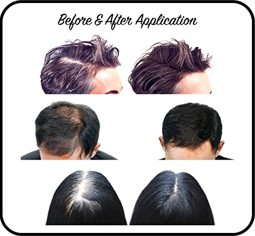 THICKIFY Hair Fibres for Thinning Hair Undetectable & Natural, 28g Bottle, Completely Conceals Hair Loss Instantly - Image 2
