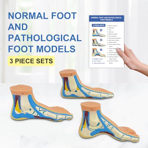 3-Piece Set Human Arch Models, Foot Pathology Anatomy Models Including Flat Feet High Arches and Normal Feet with Explanation Cards, for Medical Experimental Teaching and Educational Display Tools