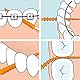 TePe EasyPick Dental Stick XS/S / 1 x 36 Stück inklusive praktischem Taschenetui / Für eine einfache, tägliche Anwendung zwischendurch und unterwegs