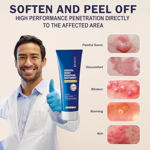 Image of MEOLY Genital Wart Remover Cream: Genital Wart Removal Ointment with Salicylic Acid Fast-Acting, Gentle for Men and Women