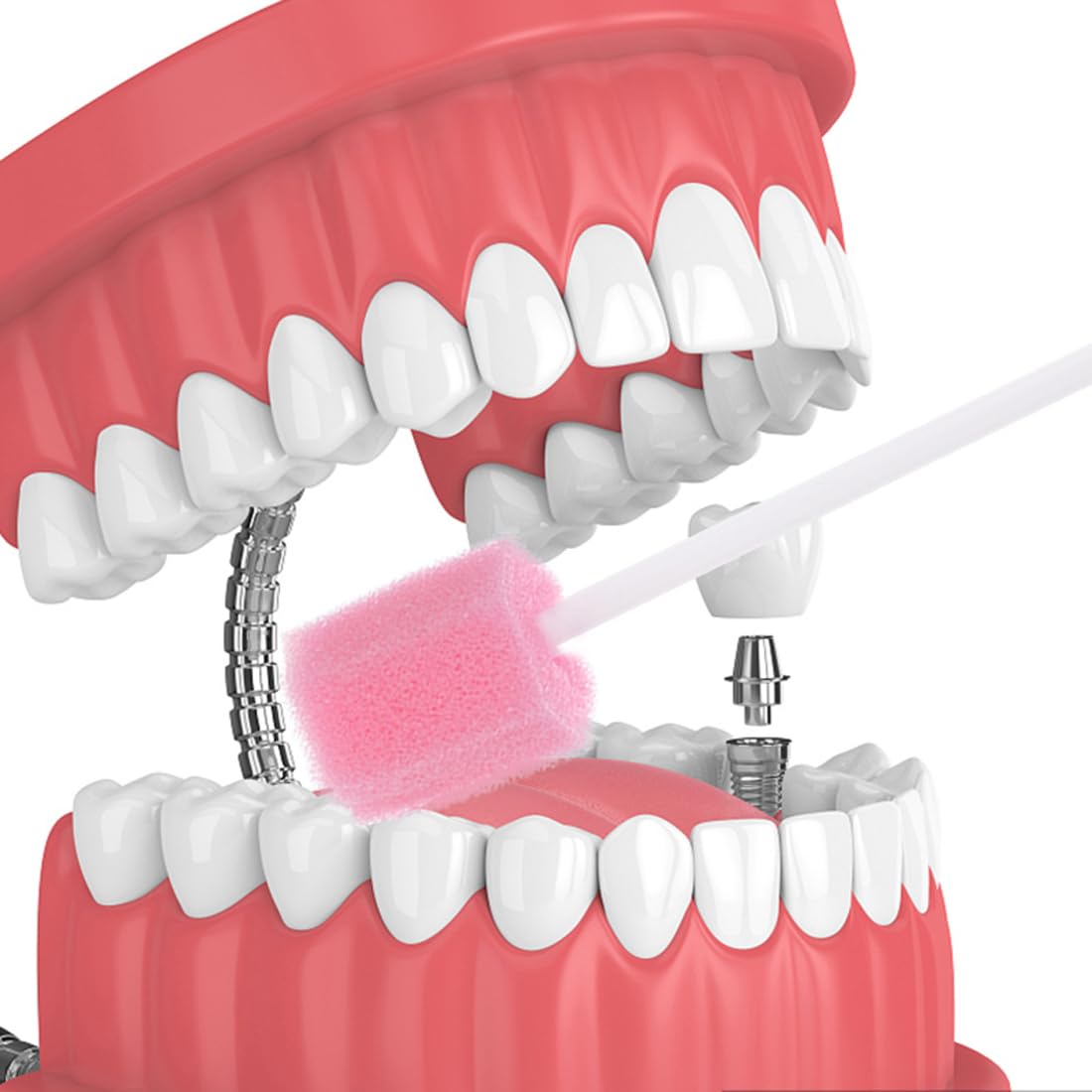 100 tamponi in spugna per l'igiene orale, usa e getta, con bastone, rosa, comodi tamponi dentali per la pulizia dei denti