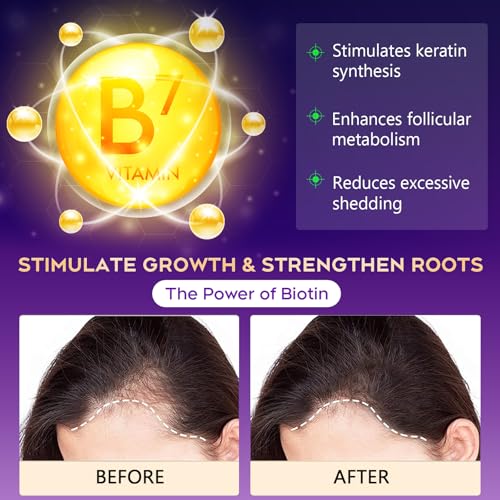 Image of Biotin Hair Growth & Thickening Shampoo with Root Activator, Hair Loss Shampoo for Men And Women, Strengthen Roots, Control Oil & Thicken Thin Hair, Sulfate-Free, for All Hair Types, 10.1 Fl Oz-Fresh