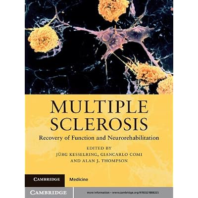 Multiple Sclerosis