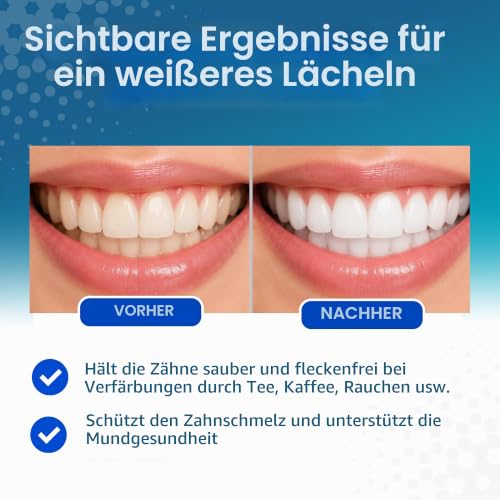 Vitis whitening Zahnpasta 100ml, 2er Pack (2x 100ml) – Ansicht 4