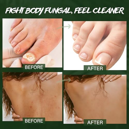 Tea Tree Oil Body & Foot Scrub, Improve Skin Fungus, Skin Itchy, Jock Itch, Foot Discomfort & Body Odor, Tea Tree Sea Salt Scrub to Exfoliate and Moisturize Skin, Deep Cleansing, 360g/12.7oz - Image 5