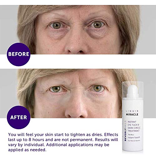 beverly hills facelift serum