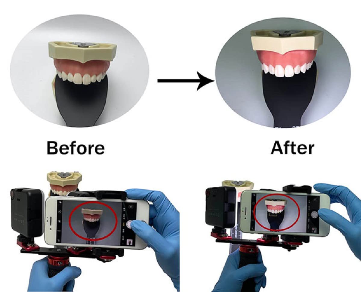 Luce Dentale Fotografica LED 64 Lampadine – Kit Macro Con Supporto Per Smartphone Per Riprese Intraorali - 5