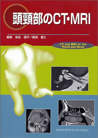 頭頸部のCT・MRI 第3版 51T3xP2Pu3L._AC_SY200_QL15_.jpg