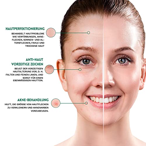 ANAiRUi Salicylsäure 2% Lösung Exfoliant Gesichtsserum und Peeling Mandelsäure 10%, mit Teebaumöl, für reduzieren dunkle… - Image 3