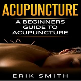 Acupuncture: A Beginner's Guide to Acupuncture cover art