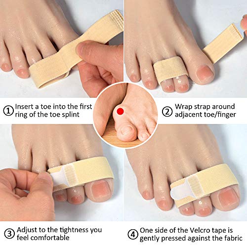 Image of Broken Adjustable Toe Wraps 8 Pack, Fabric Toe Splint Toe Cushioned Bandages Finger Toe Protectors Straightener Toe Separators, Orthopedic belts