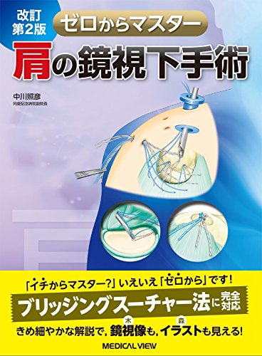 PDFダウンロード 肩の鏡視下手術 改訂第2版 (ゼロからマスター) バイ