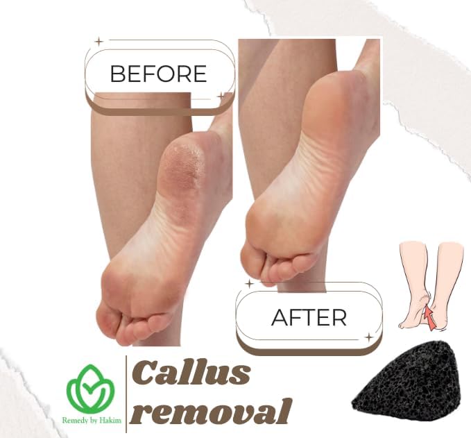 Foot Care Pumice Stone, Small, for Calluses and Exfoliation, 1 Count (Pack of 1), Black