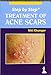 Step by Step Treatment of Acne Scars