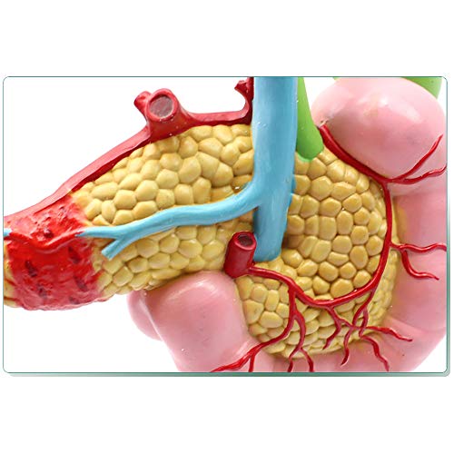 Modèle anatomique du pancréas pour expliquer les pathologies aux patients - 7