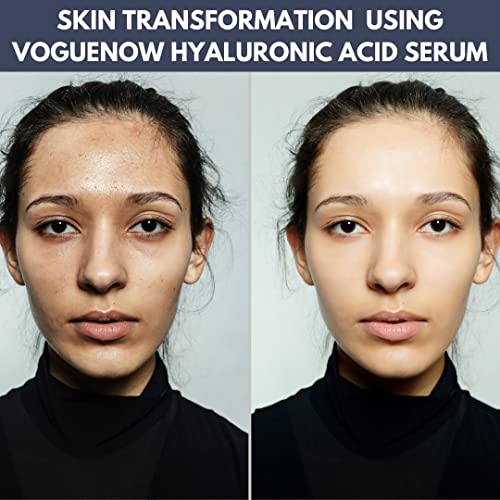 Hyaluronic Acid Serum Ampoules Pack (10Pc) - Boosts Light Therapy Results - Anti Wrinkle And Anti Aging Serum - Moisturizing And Hydrating Facial Serum. #TOP4