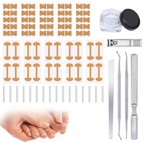 Professional Ingrown Nail Corrector Set, New Professional Ingrown Toenail Set with Breathable