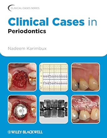 Clinical Cases in Periodontics: 42 (Clinical Cases (Dentistry))-Wow! eBook