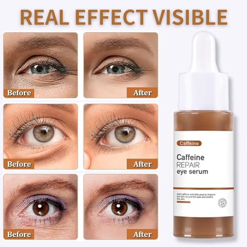Caffeine Eye Serum for Dark Circles, Under Eye Serum Caffeine Eye Cream, Dark Circles Under Eye Treatment for Women/Men Skincare, Anti Aging Wrinkle, Reduce Puffiness, Eye Bags Removal, 30ml - Image 7