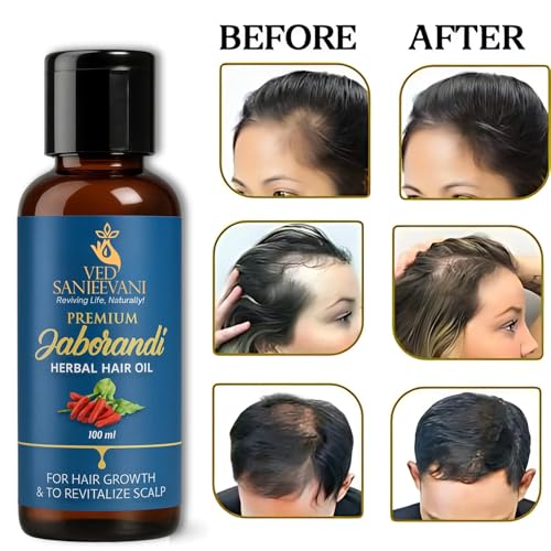 Image of Ved Sanjeevani Kesh Amrit Herbal Hair Oil | For Hair Nourishment & Shine | With Herbal Oils for Healthy Hair | 100 ml