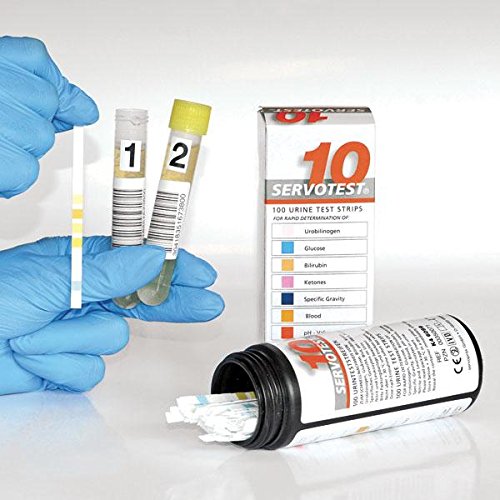 servotest Control de orina 2 x 15ml