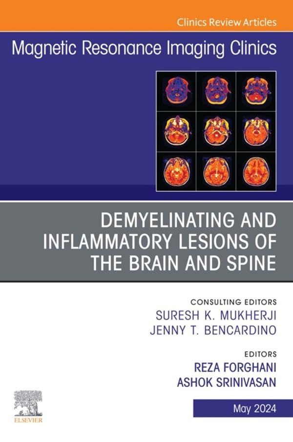 Demyelinating and Inflammatory Lesions of the Brain and Spine, An Issue of Magnetic Resonance Imaging Clinics of North America, E-Book (The Clinics: Radiology)      Kindle Edition