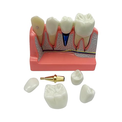Miniatura 75 de 2 modelos de dientes estándar, modelo dental para adultos, modelo estándar de demostración de Typodont para niños, enseñanza dental, pantalla